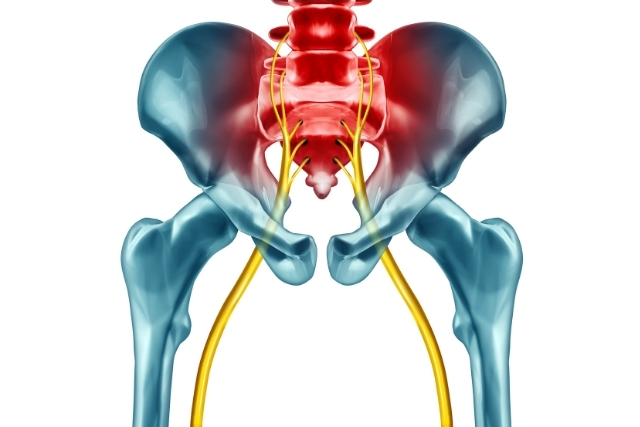 坐骨神経痛